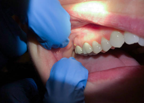 Best Walk-In Emergency Dental Services in Antioch, IL